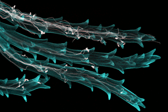 Take a microscopic view of the ergot fungus (light pink colour) infecting wheat stigma hairs (blue colour) – the winning photo from NIAB and Cambridge University in the Wellcome Image Awards 
